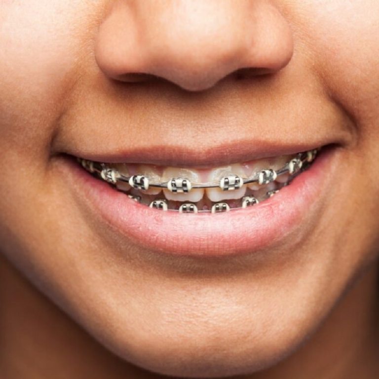 Mustafakemalpaşa-ortodontist