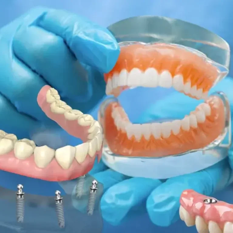 Protez Diş Nedir Nasıl Takılır